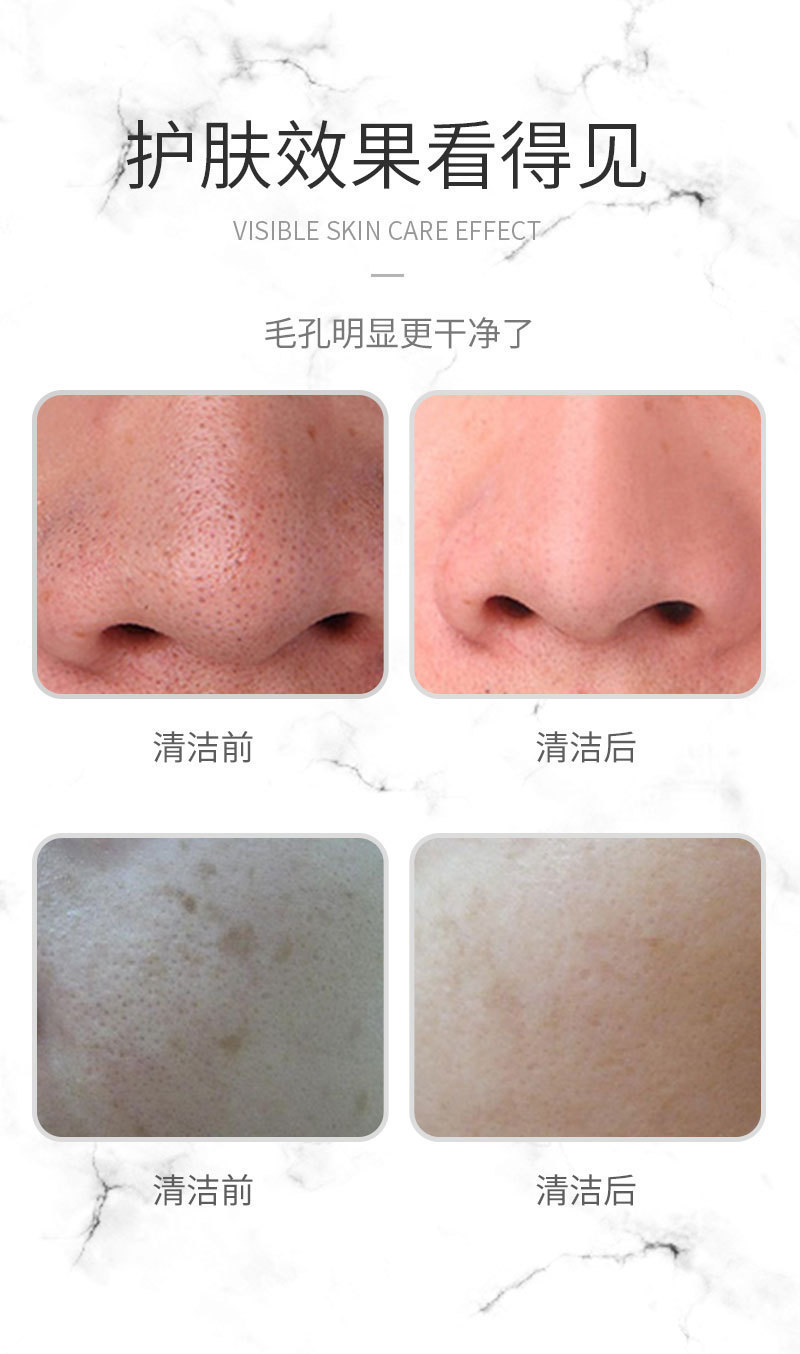 Cross-border skin peeling machine, pore cleaner, beauty device, ultrasonic skin peeling, blackhead and acne removal beauty device, export device pic 7