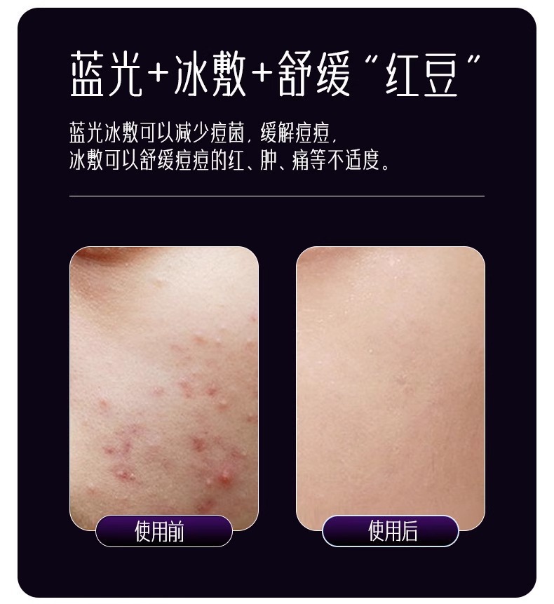 厂家家用美容仪器脸部按摩洁面法令纹提拉紧致面部导入导出仪冰敷详情15