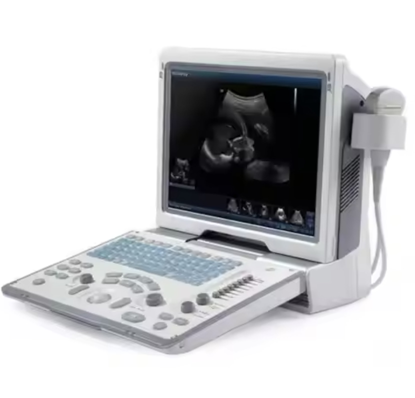 Mindray DP50 ultrasonic scanner, a color portable ultrasonic scanner, is a portable ultrasonic diagnostic system pic 9