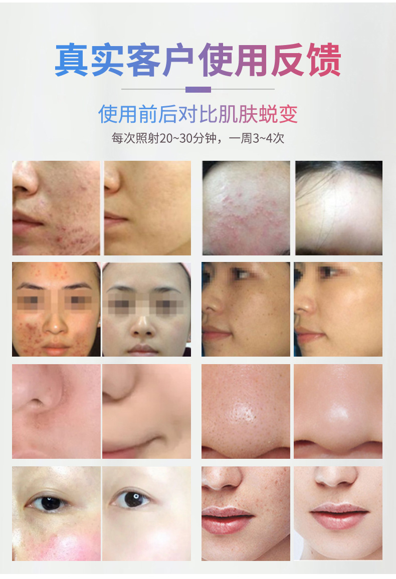 跨境光子嫩肤仪全身嫩肤光谱仪红蓝光面部祛印美容仪器LED大排灯详情17