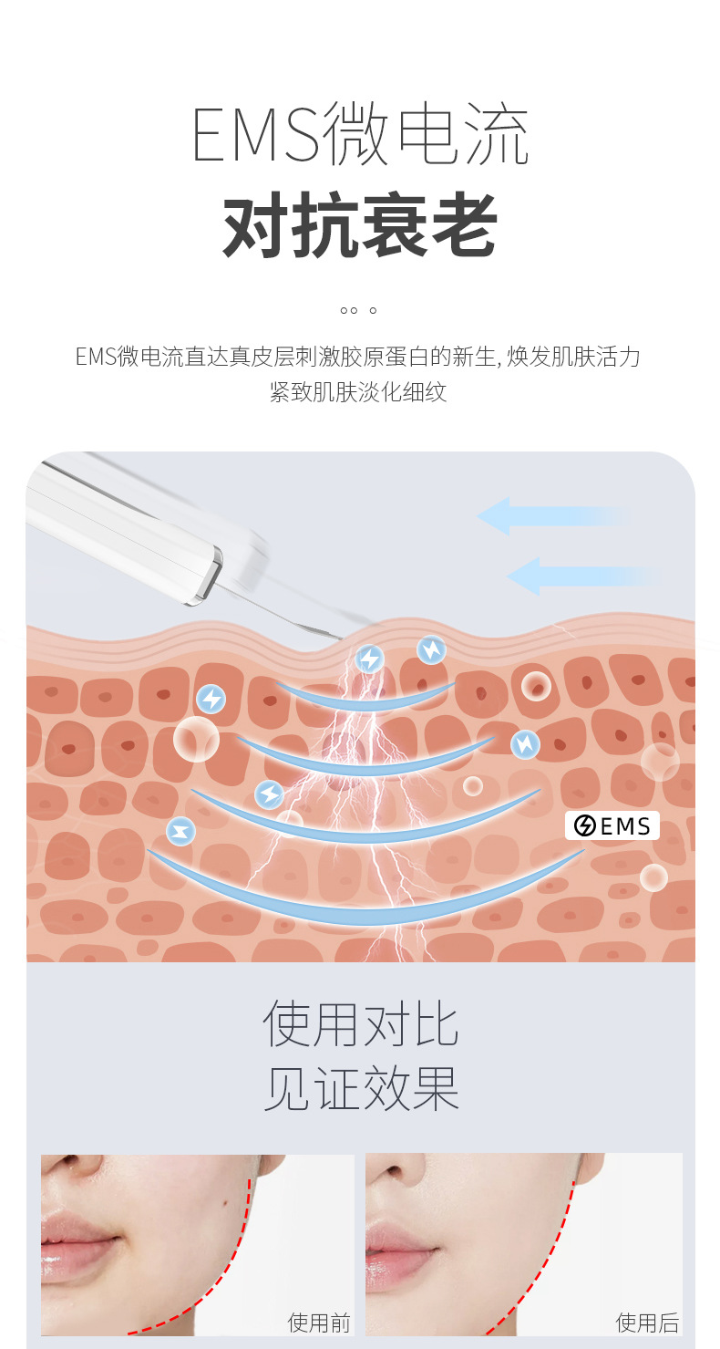 超声波铲皮机面部清洁仪毛孔清洁器脸部洁面仪黑头仪器黑头铲详情31
