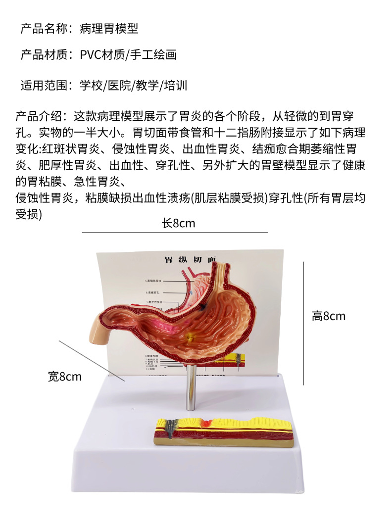 Human stomach anatomy model, traditional Chinese medicine teaching physical object, human stomach structure model, portable demonstration equipment, tuning fork to assist learning pic 6