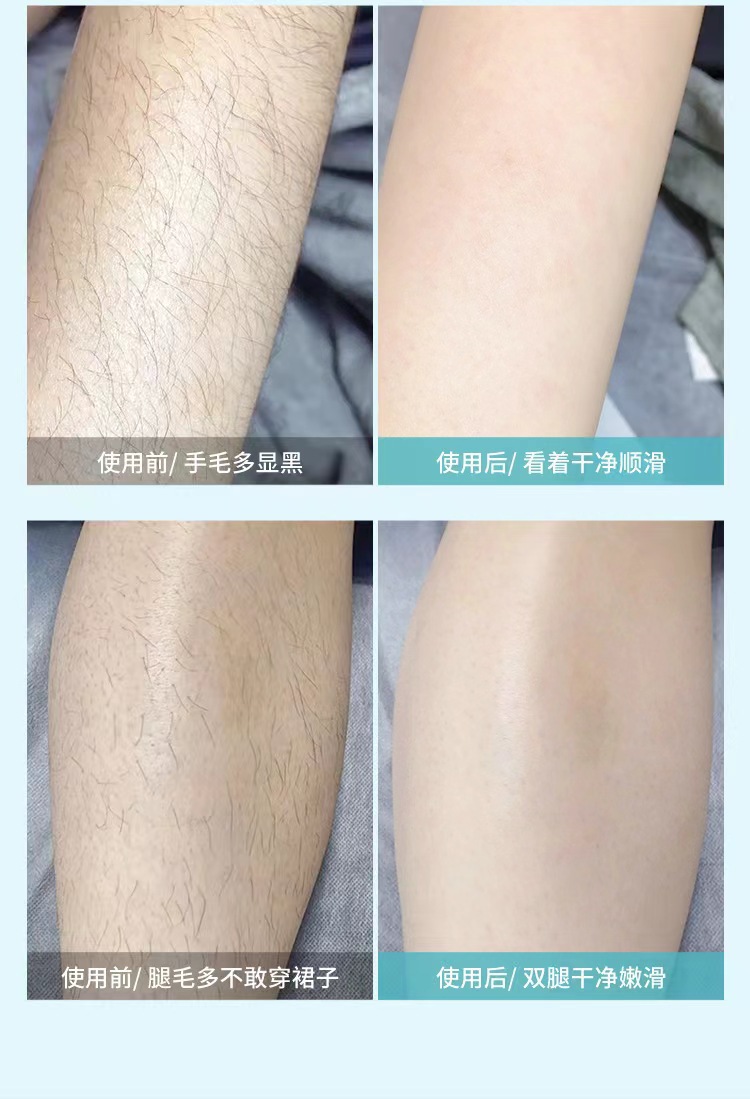 无感腋毛刀男女士通用腿毛刮毛刀剃毛刀便携式美容院微距刀片脱毛详情11