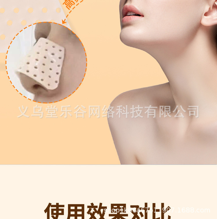 Thermoplastic nasal splint, self-molded shaping plate, nasal augmentation correction, fixation, straightening and height-increasing tool, preventing nose picking and beautifying wonder pic 7
