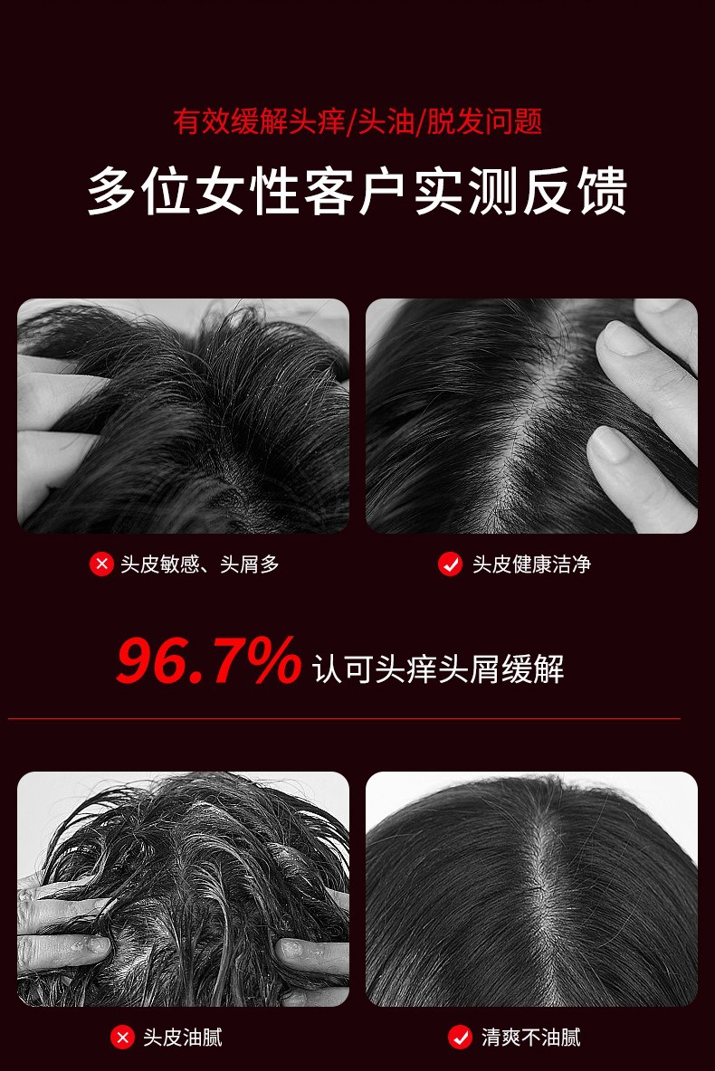 Red light electric massage comb, kneading, activating and promoting hair growth massage device, scalp medicine applicator, hair health care, fluid guiding and hair growth instrument pic 10