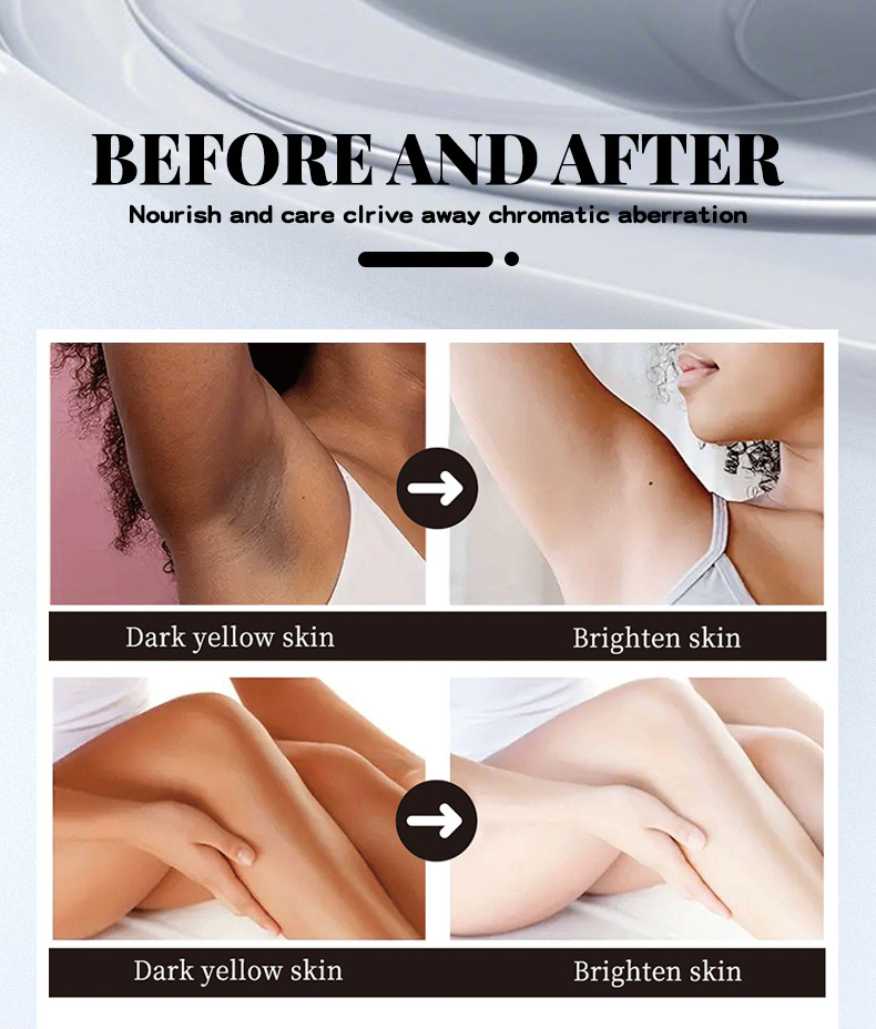 【跨境专供】魅点焕亮乳霜祛除黑斑黑色素深色膝盖身体褪黑霜批发详情5