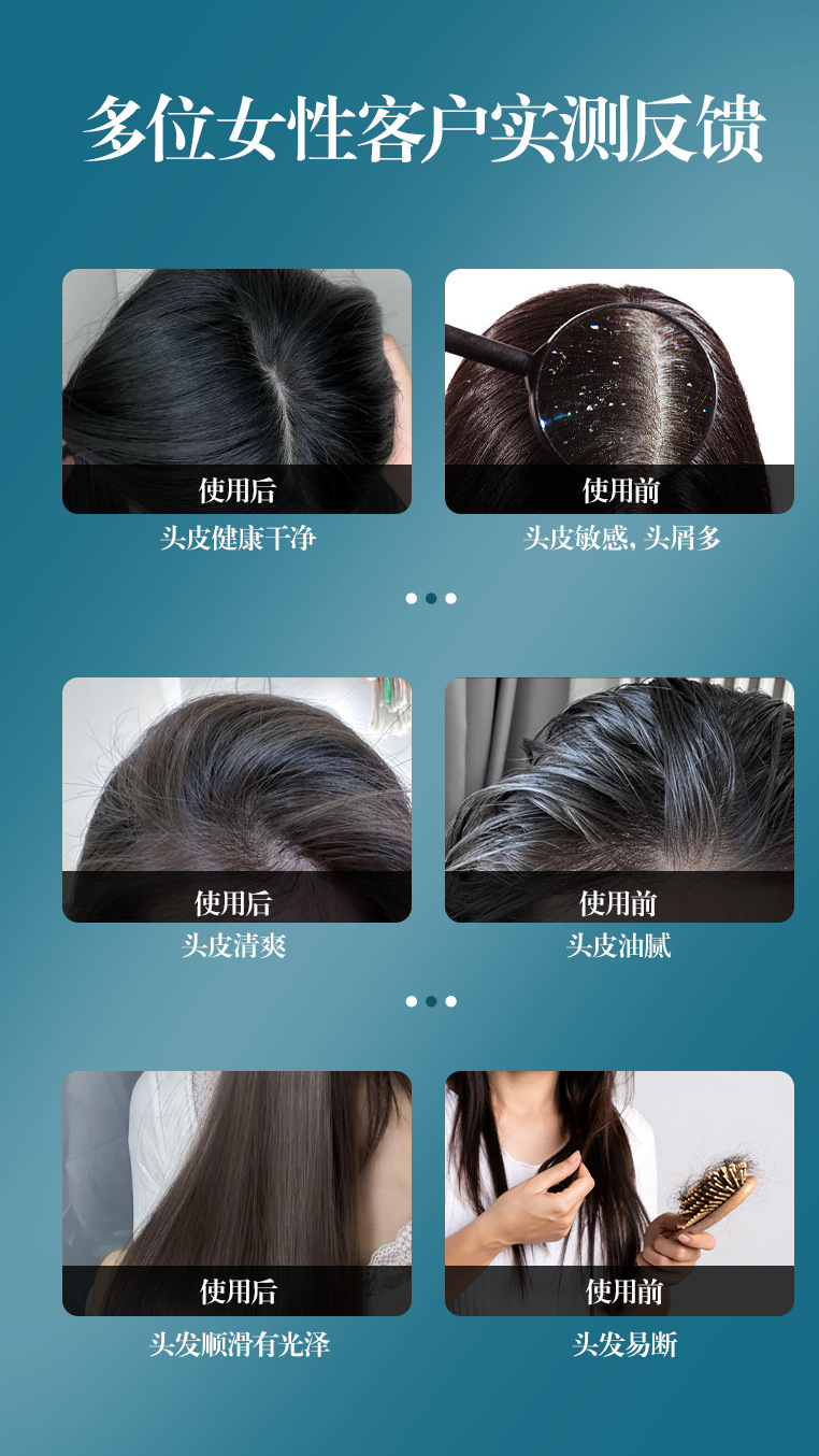 New smart hair growth massage comb, electric home scalp fluid guide comb, red light anti-hair loss, hair care and nourishment multi-functional pic 6