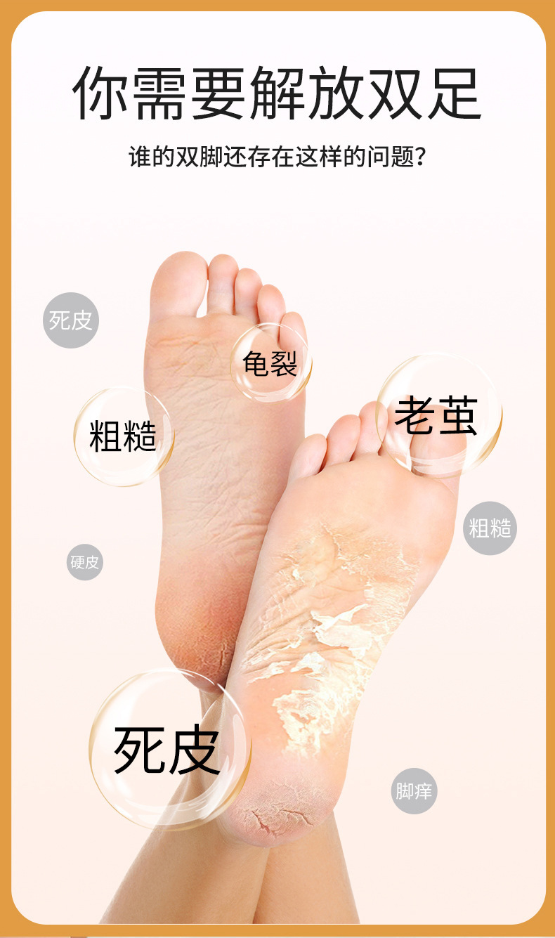 shanilak   跨境家用新款磨脚器电动修脚器脚底脚后跟修脚死皮打磨用工具详情4
