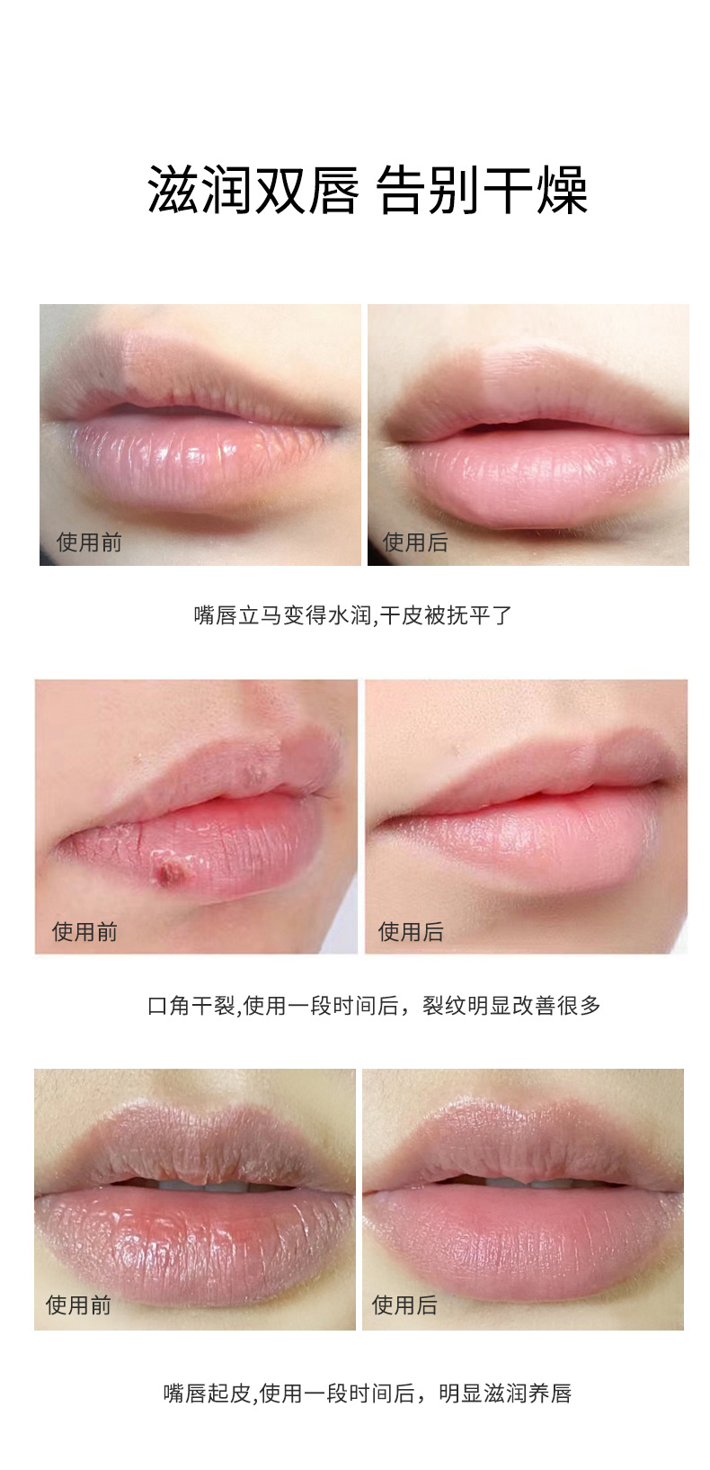 Lacey Vaseline Lip Balm Moisturizes, hydrates and moisturizes for autumn and winter, prevents dryness and cracking, removes dead skin, nourishes and repairs. Student lip balm pic 11