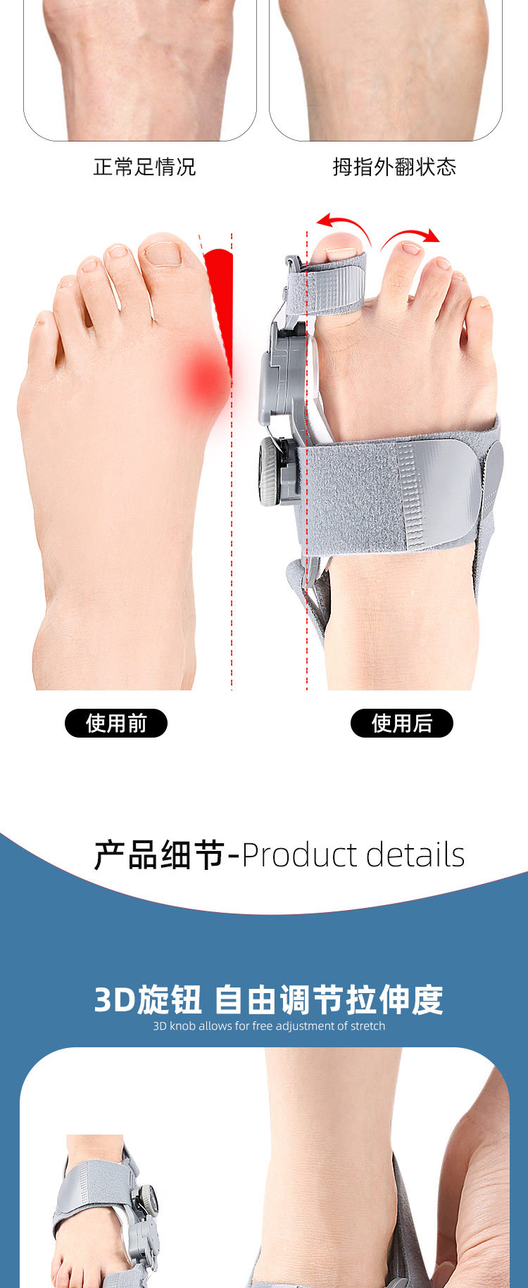 Thumb eversion orthosis, big foot bone protrusion overlapping toe separator, day and night adjustable knob orthosis pic 3