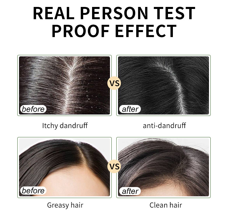 Specialized export cross-border supply 44 Shampoo, Olive Lemon Shampoo, Aloe Vera Avocado Shampoo, Deep Cleansing and Nourishing Body Wash pic 11