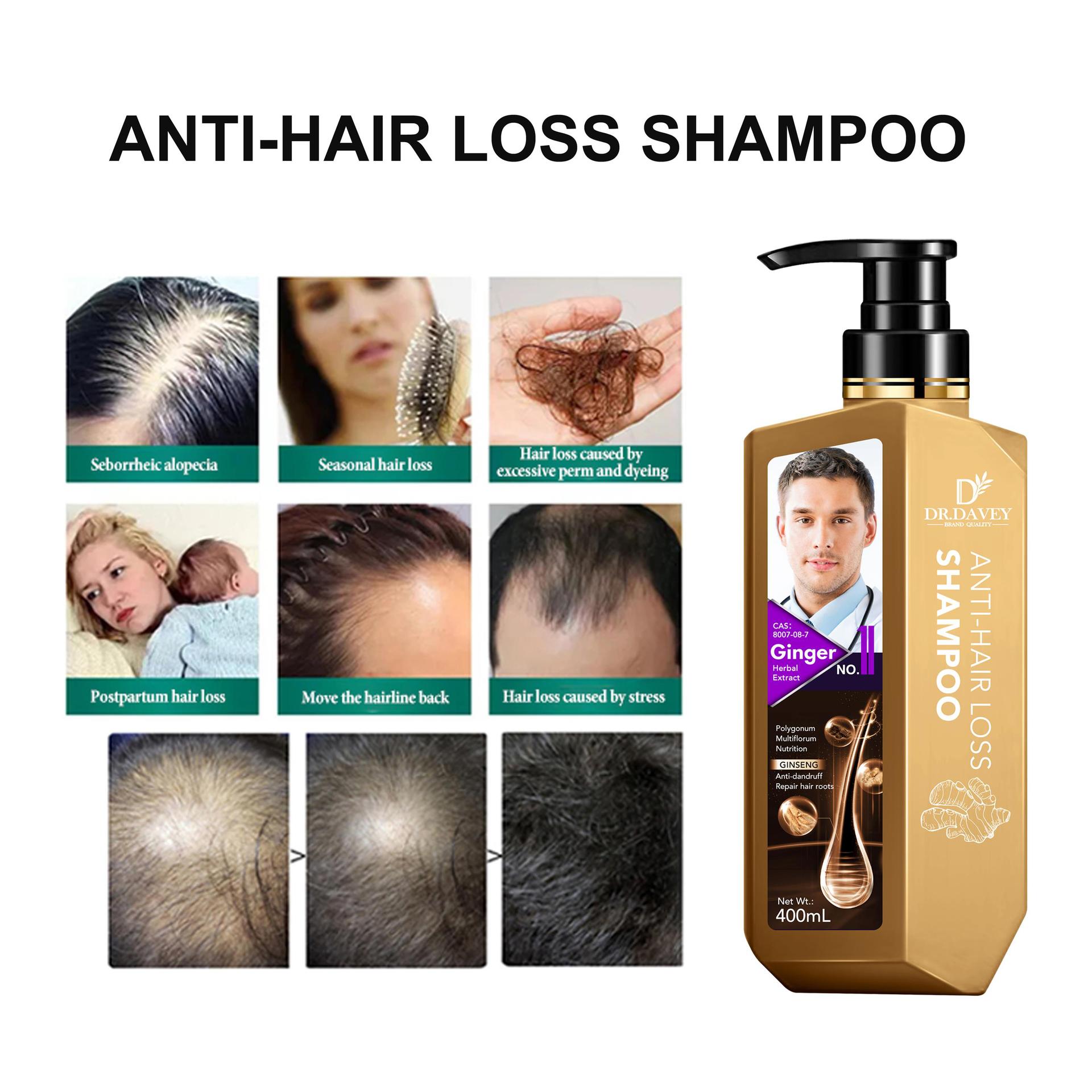 Anti-hair loss shampoo Anti-dandruff shampoo Deep Cleansing pic 3