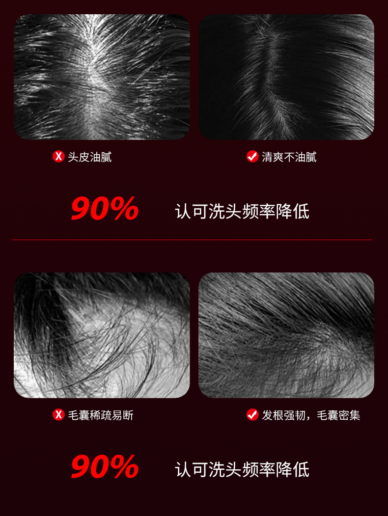 Cross-border massage comb liquid hair care massage and kneading electric waterproof small scalp care medicine applicator Massager pic 13