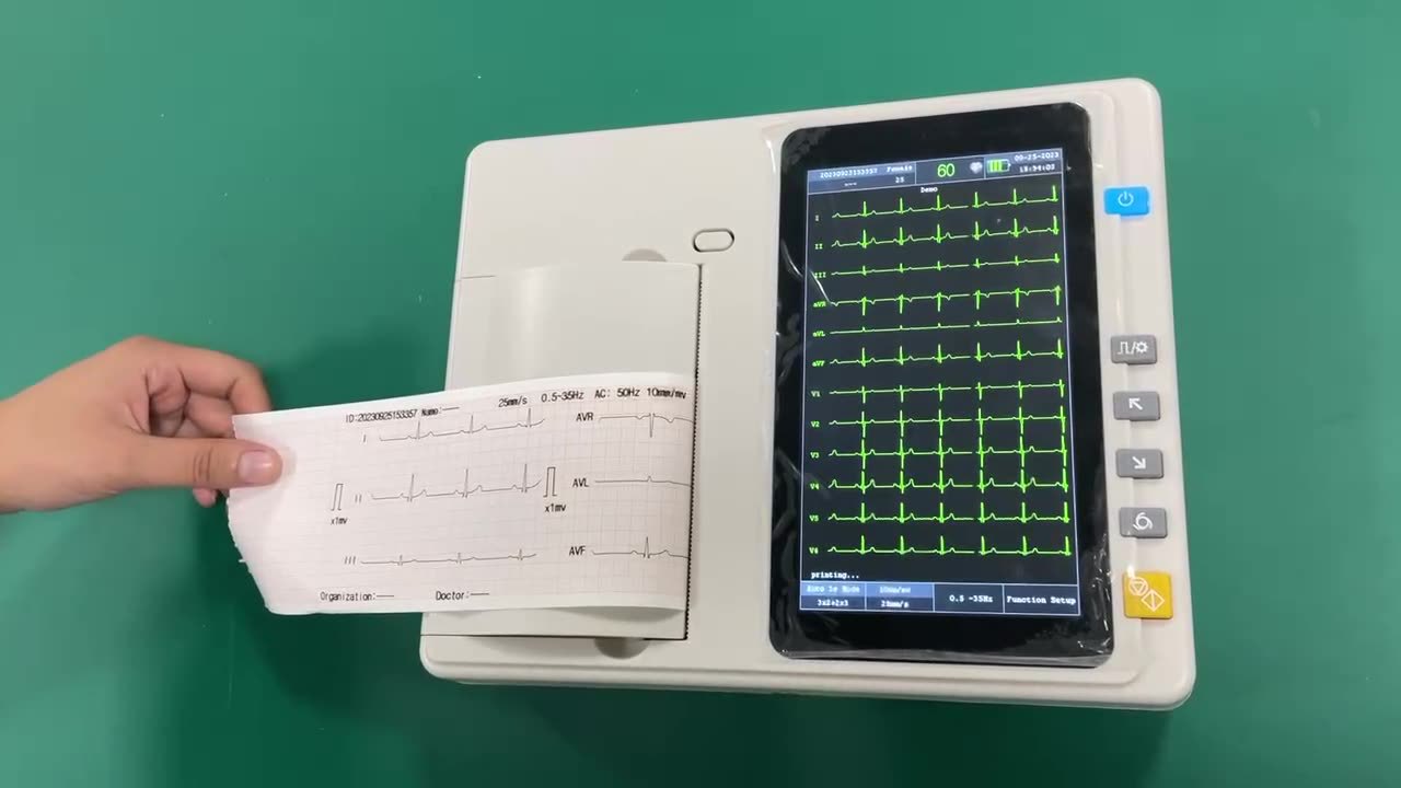 跨境专供ECG601心电图机便携式ECG machine医院专用六导心电图机详情6