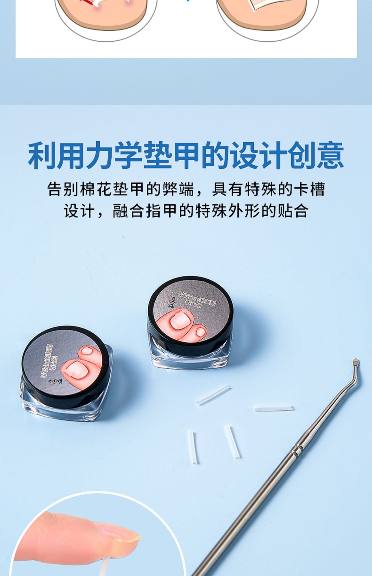 Nail groove corrector, a must-have tool for inflammation, nail straightening patch, nail patch, ingrown toenail, toenail growing into the flesh correction, filling and gasket pic 2