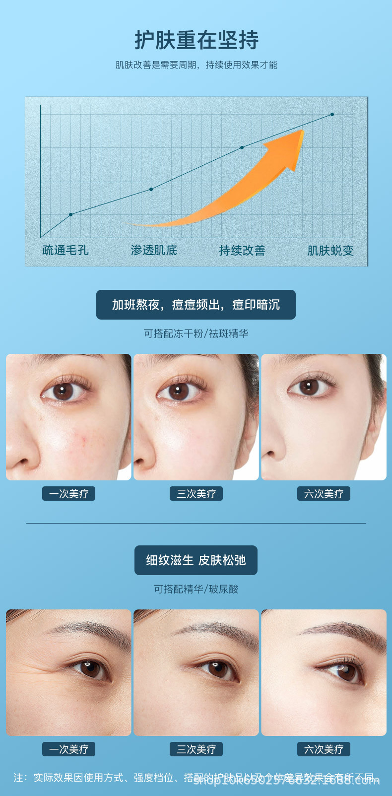 shanilak Cross-border Color Light Ice Compress Device, Microcrystalline pen, Home Cinema Line Nano Microcrystalline Essence, Freeze-dried powder, Water Light Introduction Hot compress pic 10