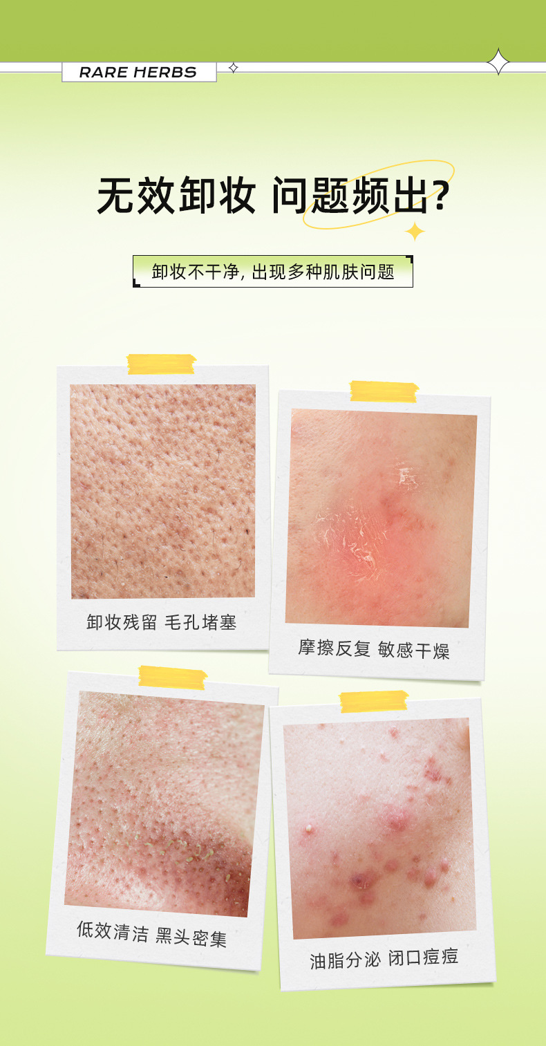 牛油果卸妆膏温和不刺激眼唇脸三合一摇滚动物园敏感肌卸妆油乳液详情3