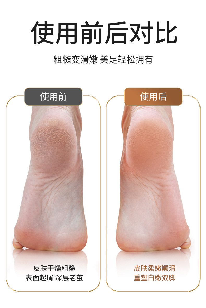 磨脚去死皮仪器修足电动磨脚器石修脚器去脚皮脚后跟老茧详情15