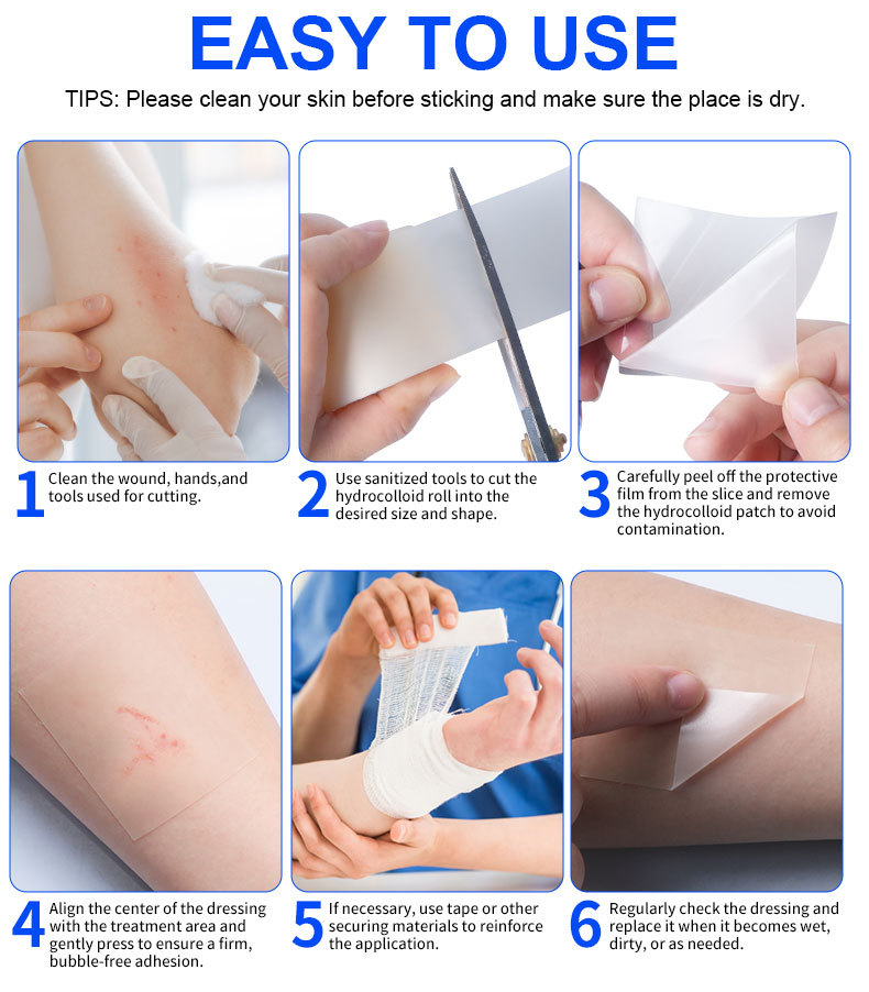 Amazon hydrocolloid roll wound dressing has strong water absorption. It is a hydrocolloid dressing for wet healing of superficial burns with liquid absorption pic 8