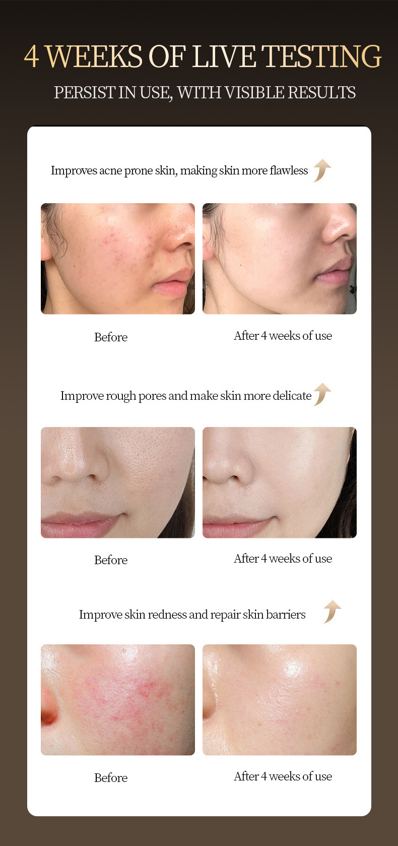 硅胶彩光光子面罩嫩肤仪脸部红蓝光美容面膜仪美容仪家用大排灯详情19