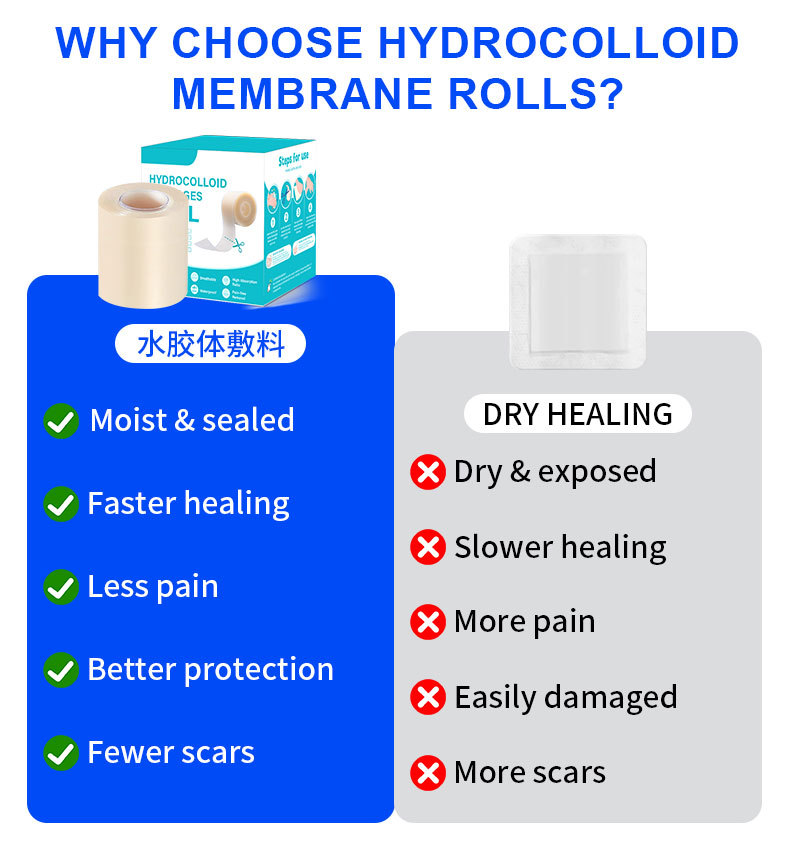 Amazon hydrocolloid roll wound dressing has strong water absorption. It is a hydrocolloid dressing for wet healing of superficial burns with liquid absorption pic 4