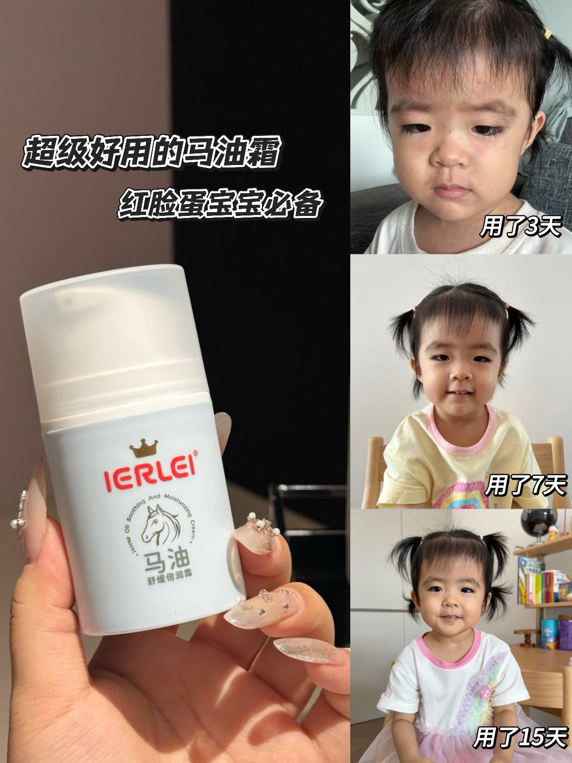 医儿乐IERLEI新包装马油婴儿面霜秋冬面霜婴儿润肤霜月龄1-6月详情5