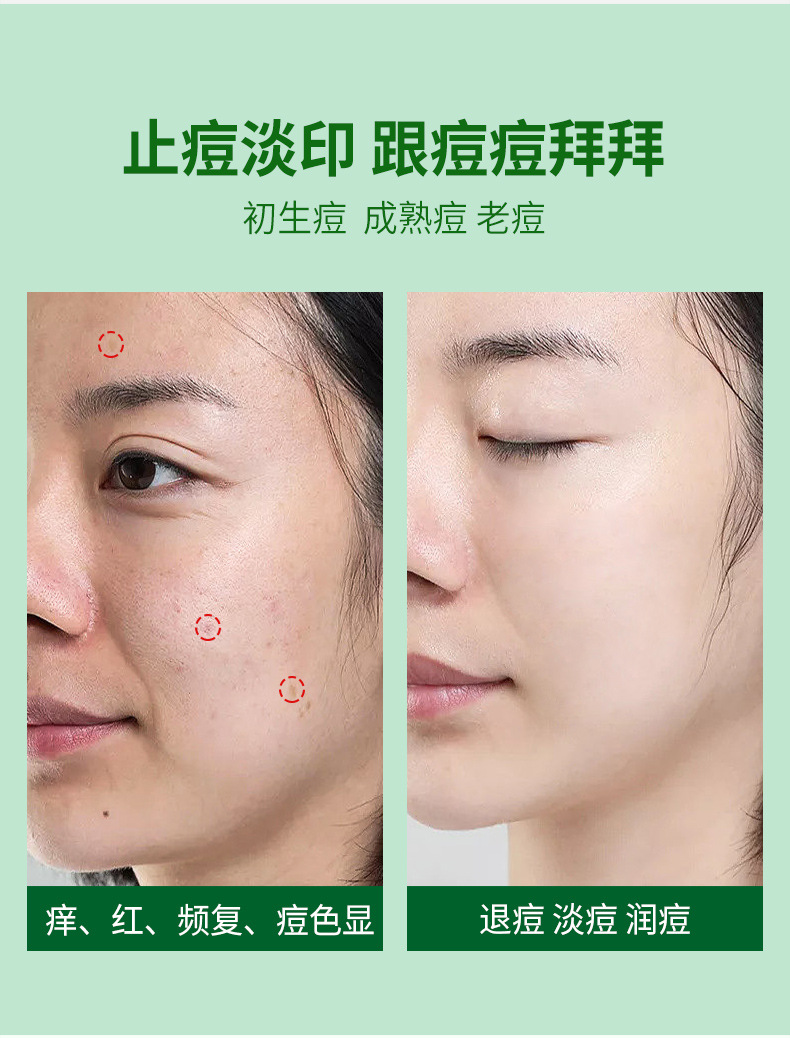 热卖OPOSi库拉索芦荟凝胶500g大容量面部护理淡化痘保湿补水润肤详情5