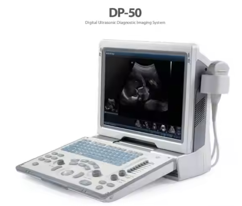 Mindray DP50 ultrasonic scanner, a color portable ultrasonic scanner, is a portable ultrasonic diagnostic system pic 6
