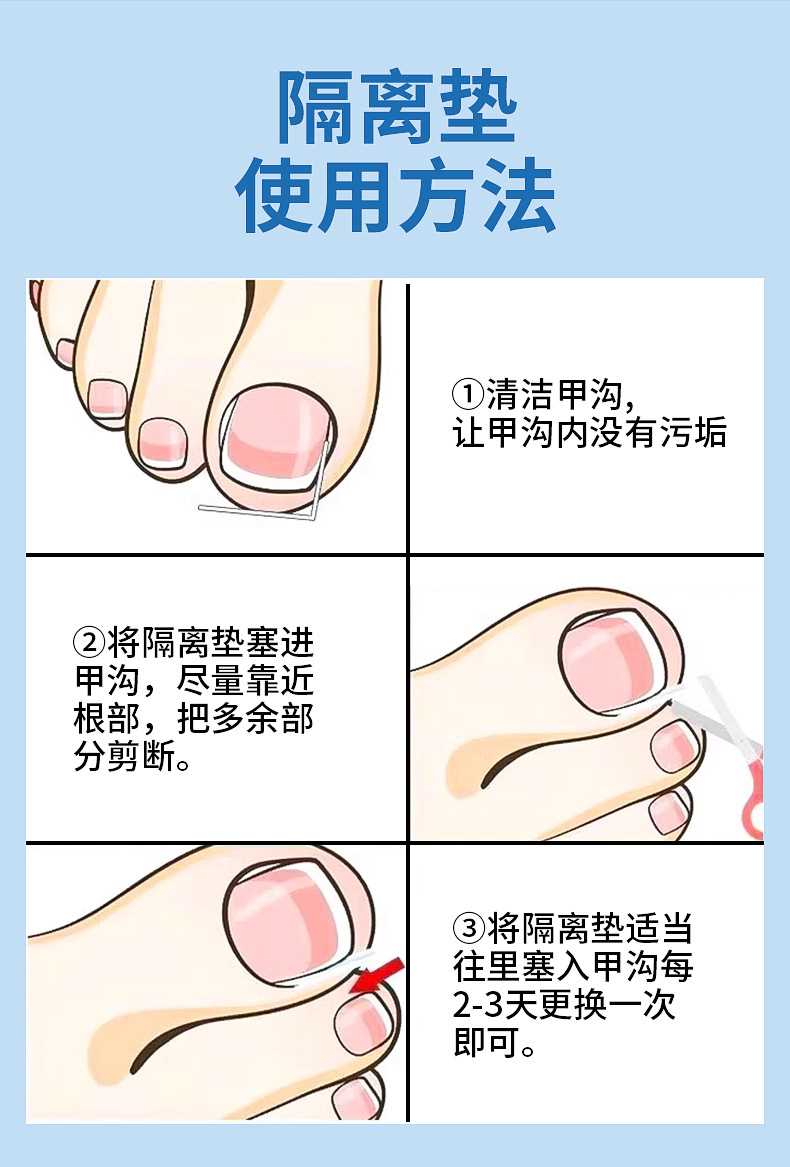 Nail groove corrector, a must-have tool for inflammation, nail straightening patch, nail patch, ingrown toenail, toenail growing into the flesh correction, filling and gasket pic 8