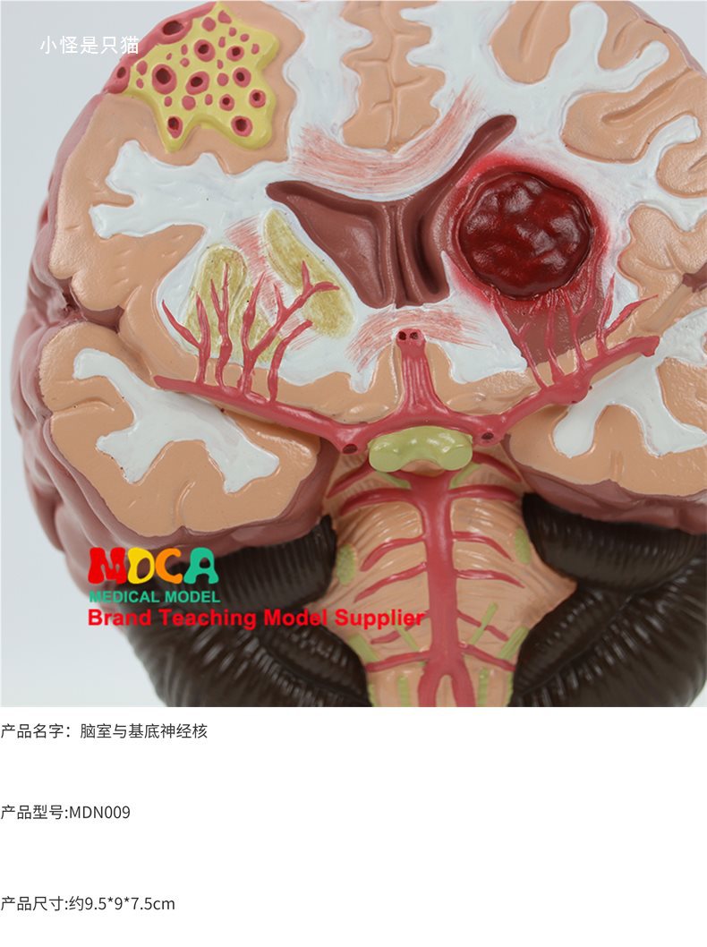 右半大脑解剖模型人体1:1神经皮质结构与功能分区医学教学详情21