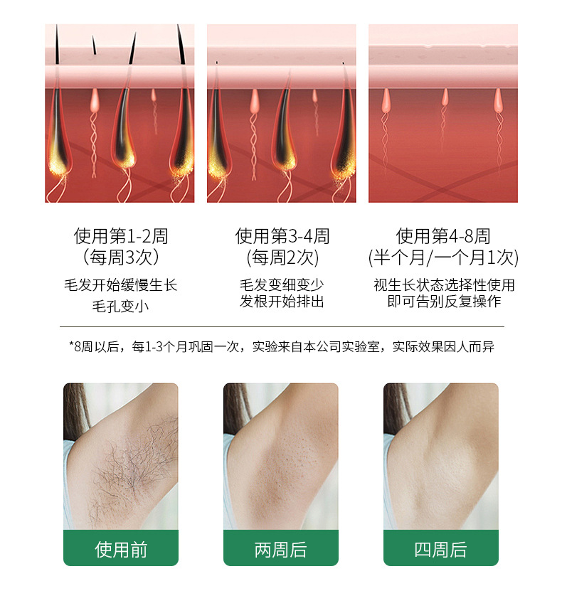 FDA manufacturer wholesale full-body skin rejuvenation beauty device, portable hair cleaning device, handheld photon skin rejuvenation 510K pic 12