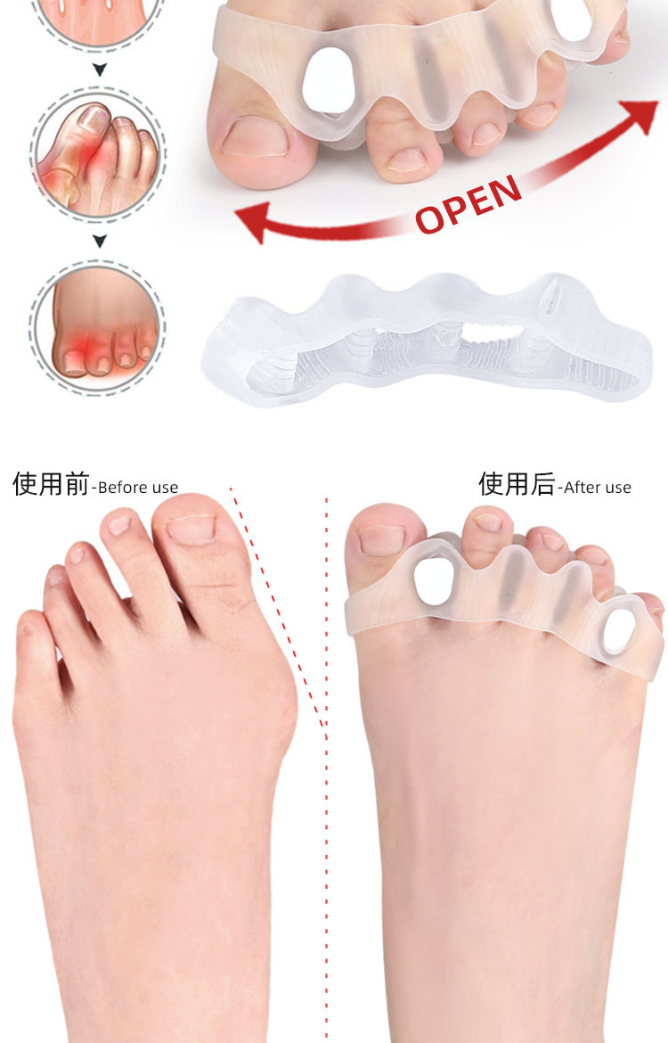 Five-hole toe separator for hallux valgus, bigfoot bone overlapping toe orthosis, detachable sponge plug foot separator pic 4