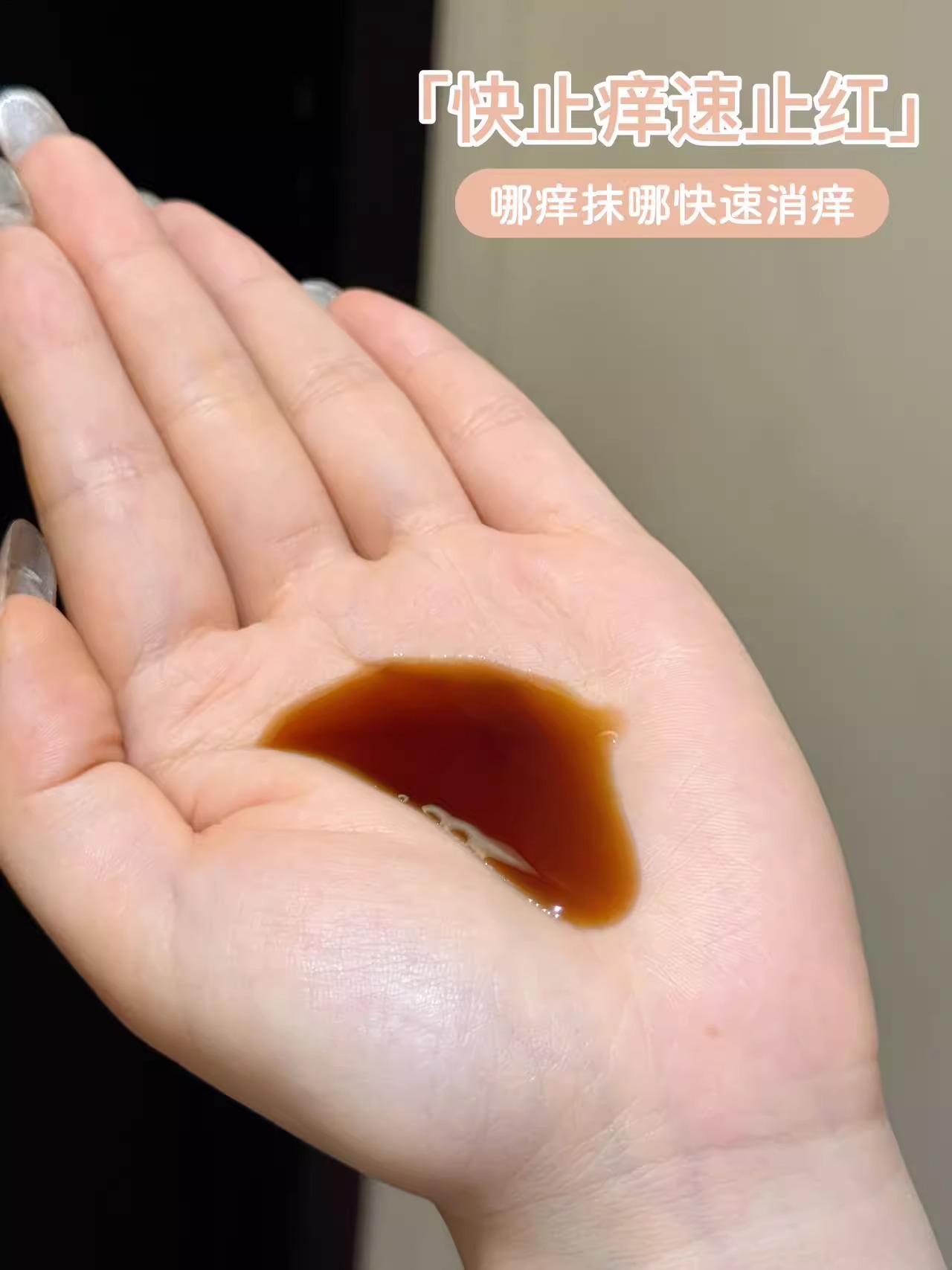 IERLEI医儿乐蚊叮消全新升级蚊叮消乳膏蚊虫叮咬驱蚊液小孩通用详情14