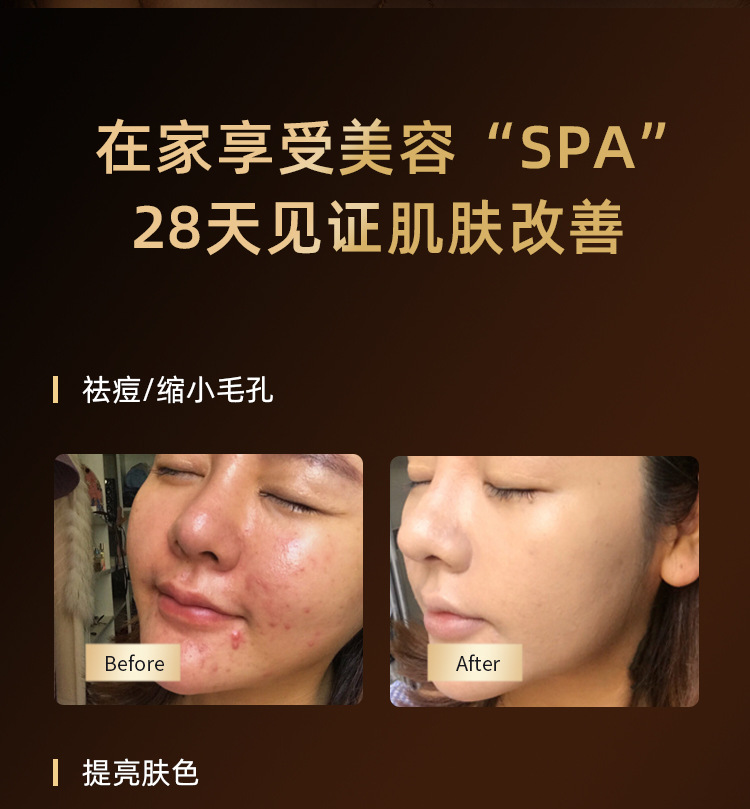 新品跨境电商爆品大排灯美容仪家用脸部全身美肤嫩白光子嫩肤美容详情4