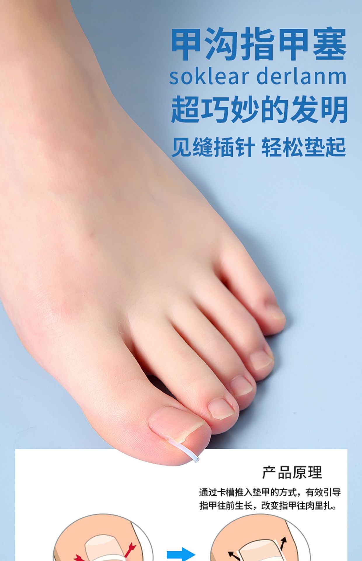 Nail groove corrector, a must-have tool for inflammation, nail straightening patch, nail patch, ingrown toenail, toenail growing into the flesh correction, filling and gasket pic 1