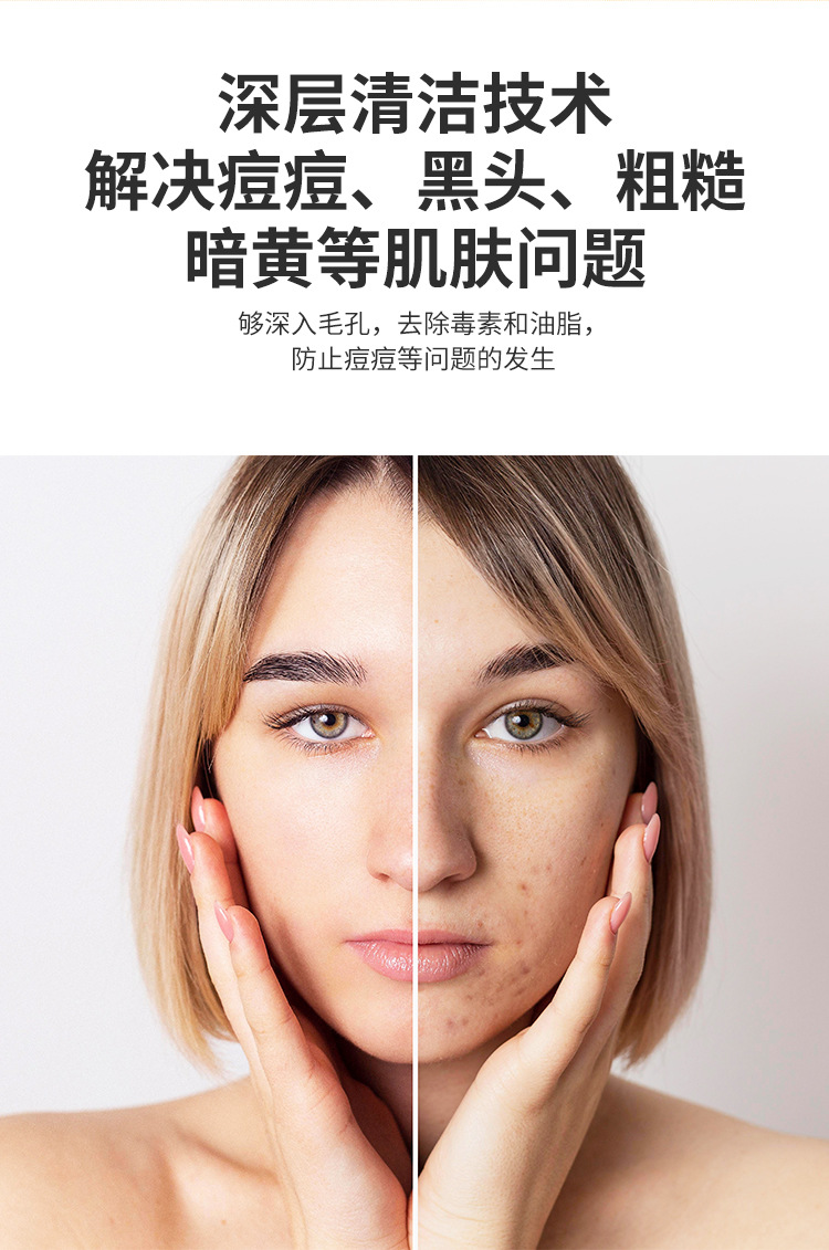 Wholesale of electric facial cleansing devices, facial lifting and firming beauty devices, portable vibration massage devices, and ion introduction devices pic 6