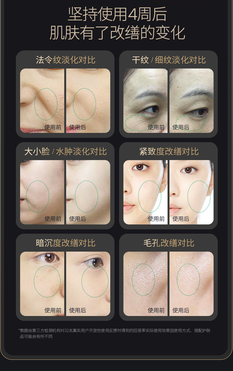 shanilak   胶原炮导入仪家用面部美容仪提拉紧致胶原提升美容院用详情12