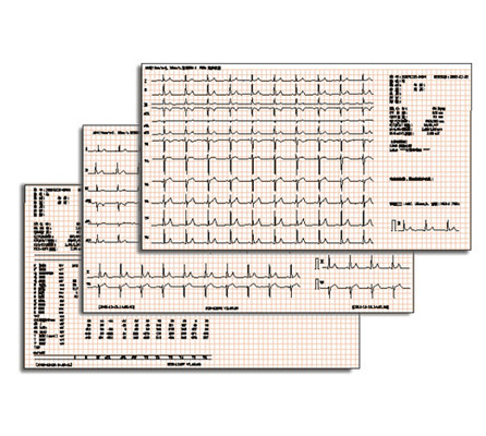 Specialized for foreign trade export of digital three-channel, six-channel and twelve-channel electrocardiogram machines and portable automatic analysis electrocardiogram instruments pic 14