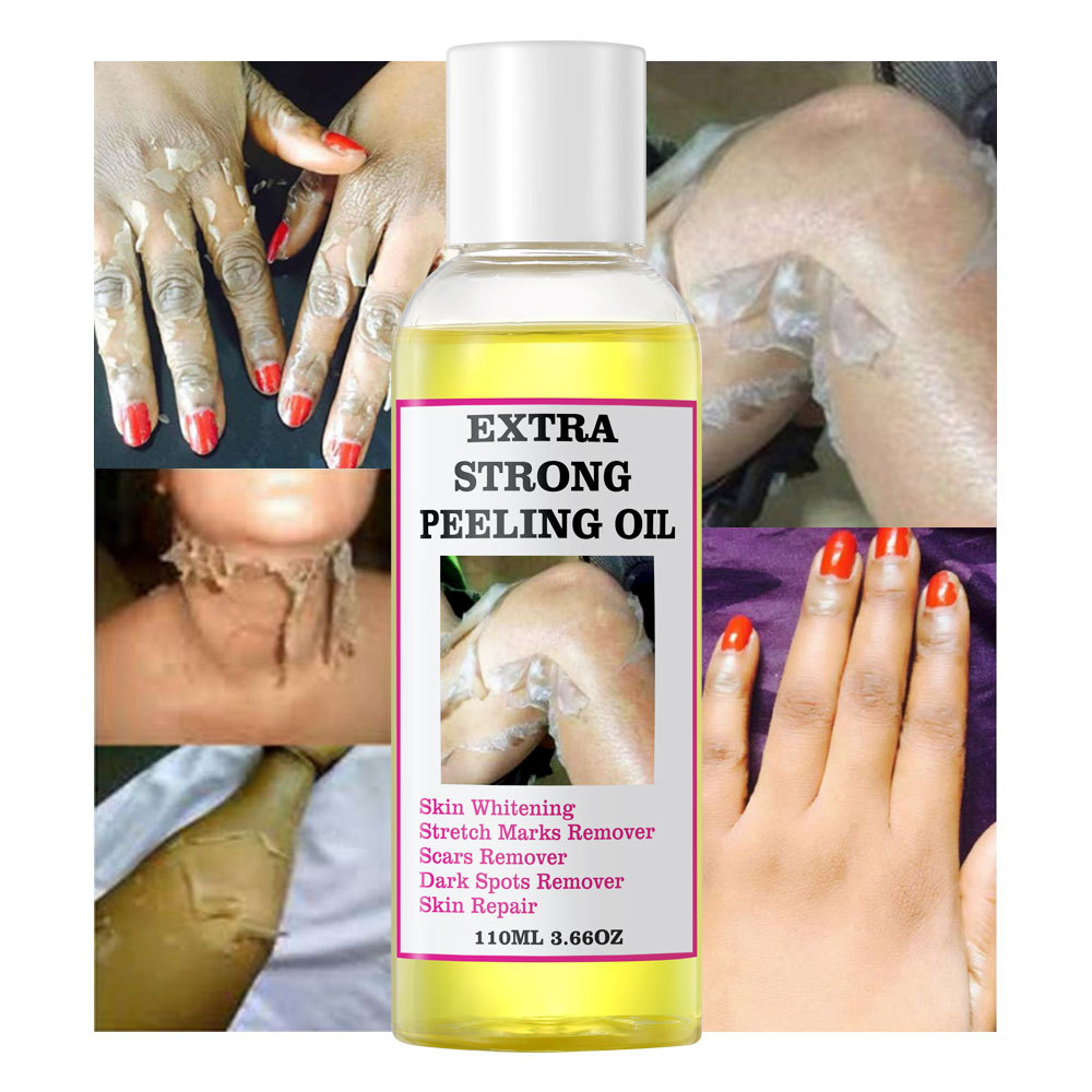 Yellow Peeling Oil跨境脱皮油 去角质油 肘部膝盖手指黑色黄皮油 身体磨砂专用 深层清洁皮肤