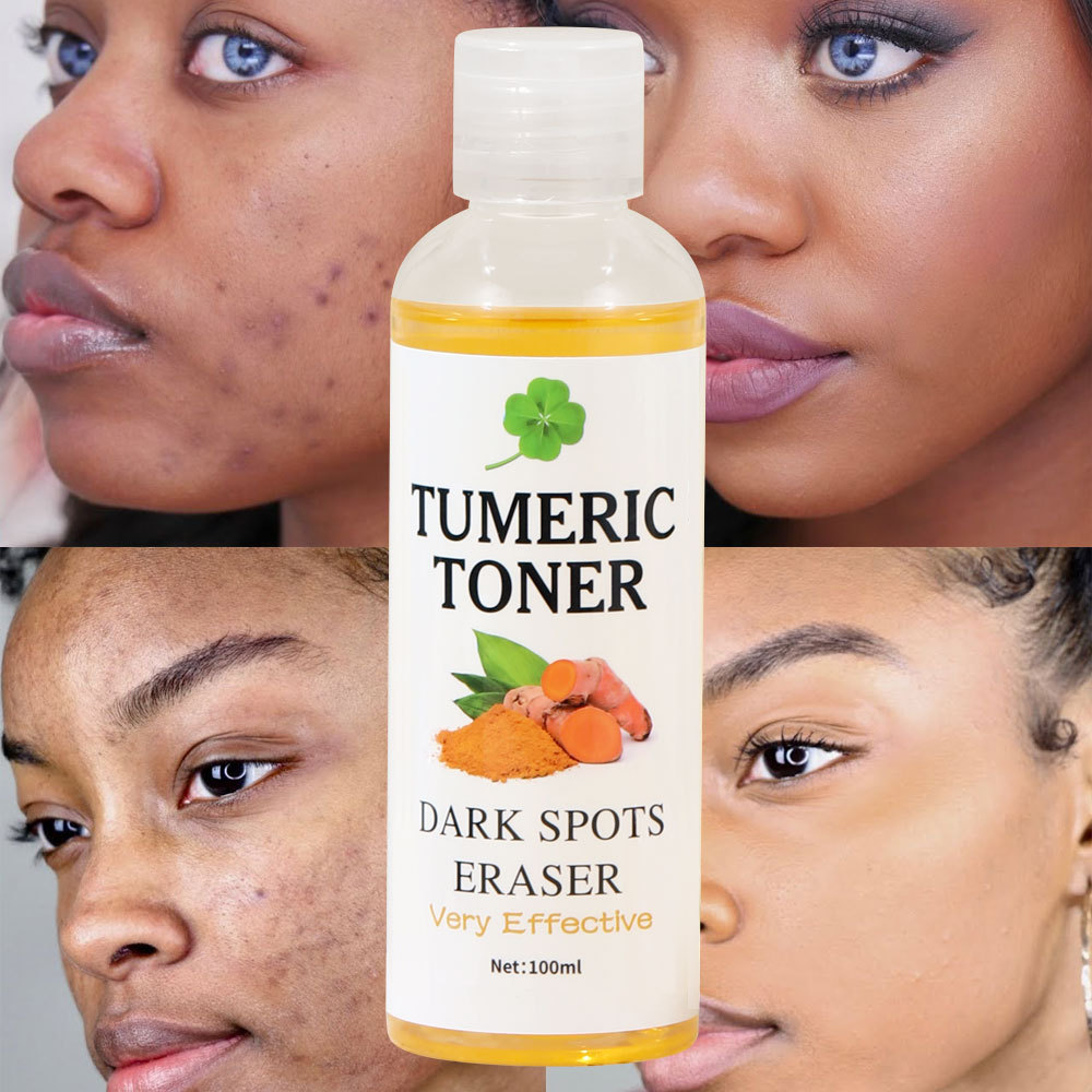 跨境新品 Dark Spots Eraser 黑姜黄爽肤水 柔肤水祛斑化妆水 Turmeric Toner 深层清洁保湿提亮肤色