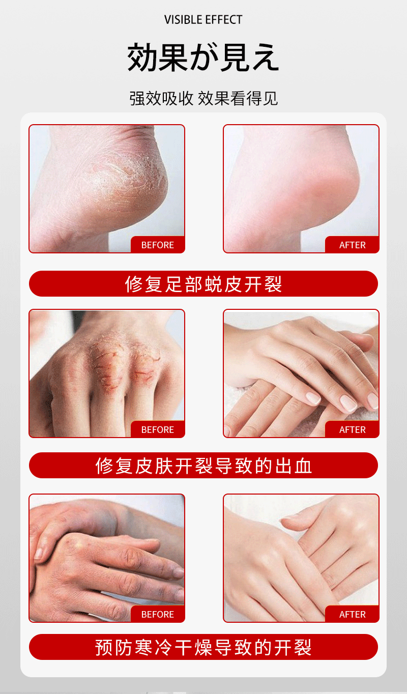 Japanese SASAYAMA Chapping Cream, Hand and Foot Anti-Cracking Moisturizing and Nourishing Hand Cream 60g, Moisturizing and hydrating Chapping cream pic 7
