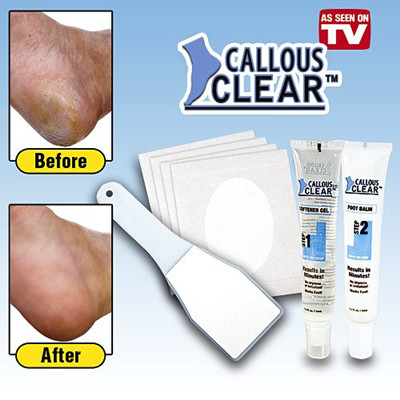 Callous Clear. Callous clear