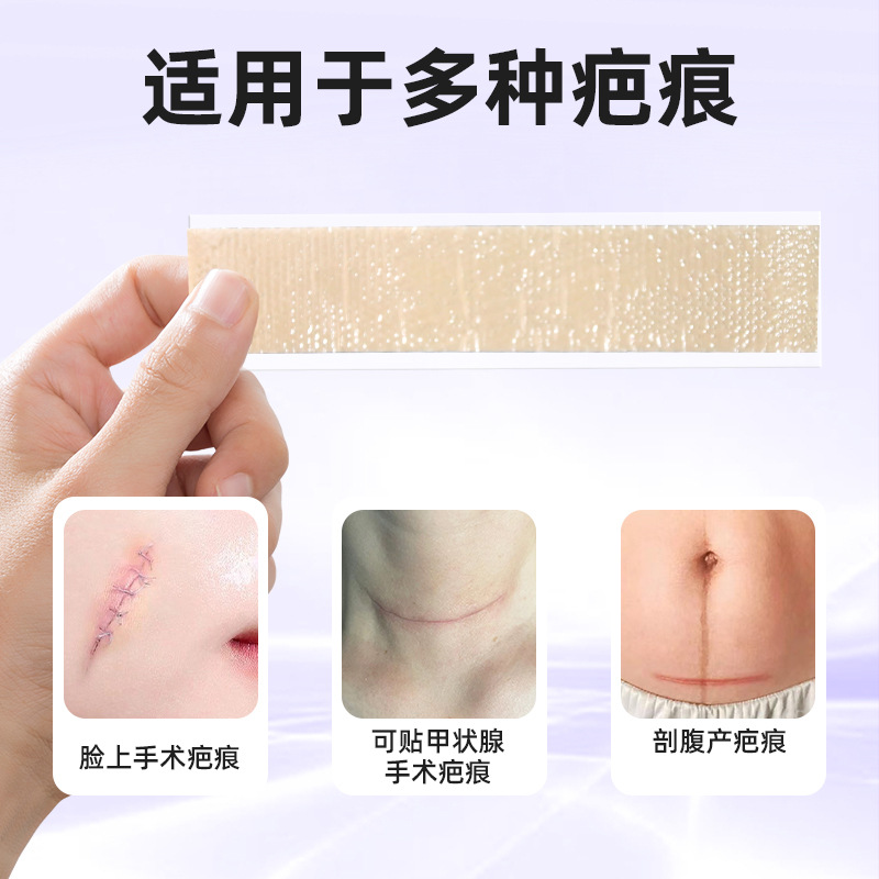 Medical scar patches, silicone gel for cesarean section, thyroid surgery, scar lightening after thyroid surgery, double eyelid surgery, hyperplasia wound customization Application Scenario