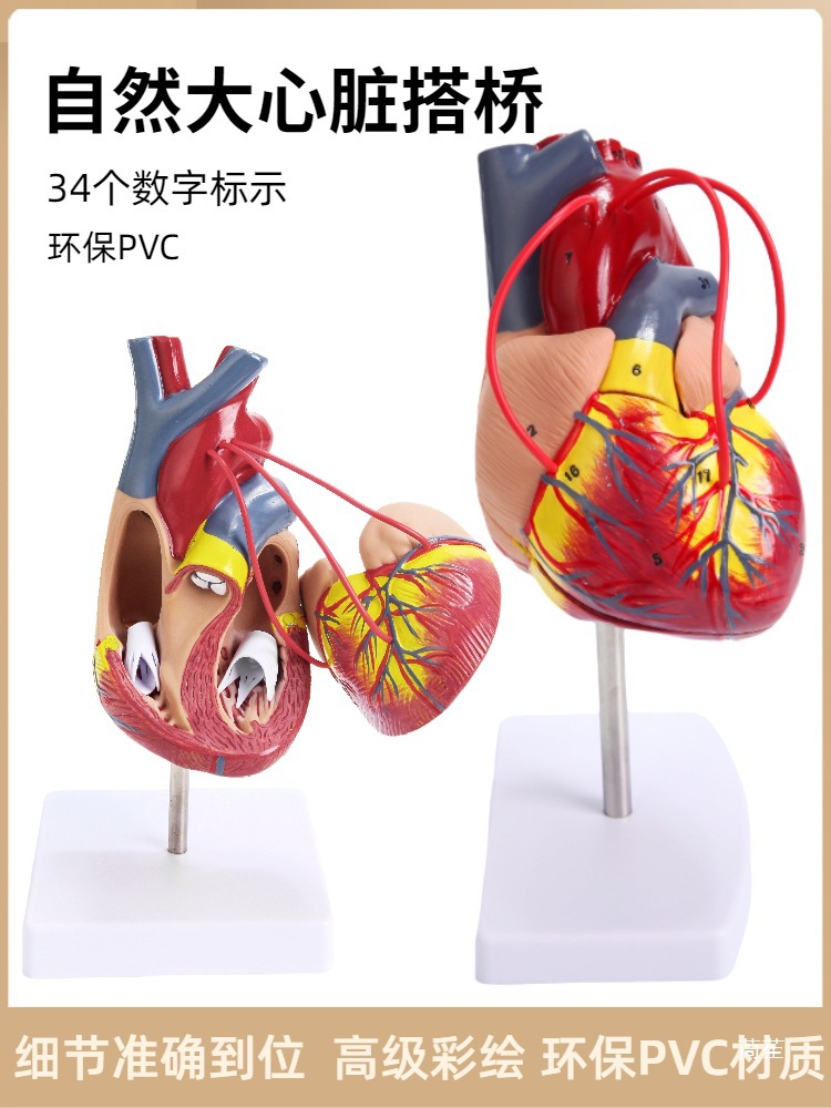 Standard human heart anatomy model B-ultrasound color Doppler ultrasound detachable natural large heart medical teaching aid model Item Picture