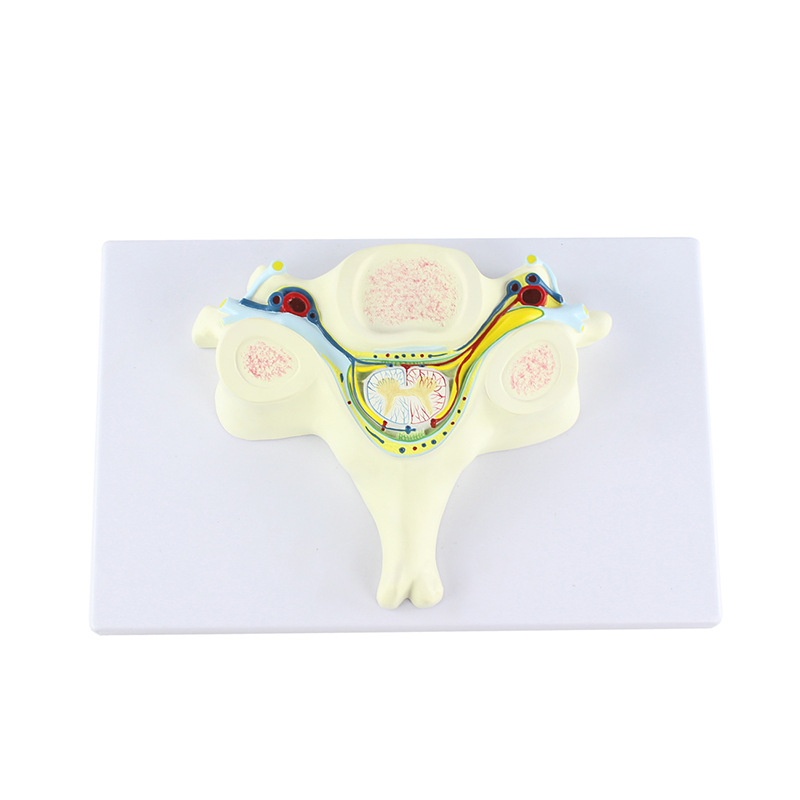 Teaching model of the fifth cervical vertebra with spinal cord and spinal nerve magnification model, medical acupoint teaching supplies Item Picture