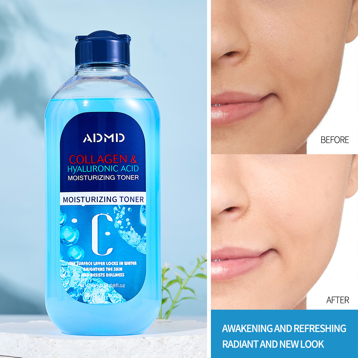【 Cross-border Exclusive 】ADMD Collagen Toner Hydrating Moisturizing Toner Wholesale Cross-border Skin Care Products Application Scenario
