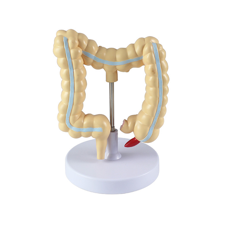 Wholesale of human colon lesion model props for school medical college teaching with high detail reproduction Item Picture