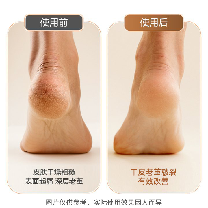电动磨脚器产品图