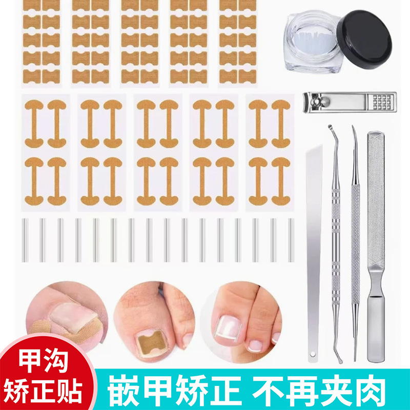 shanilak 跨境甲沟矫正器嵌甲矫正器脚趾甲卷指甲纠正神器正甲拉炎正甲贴片图