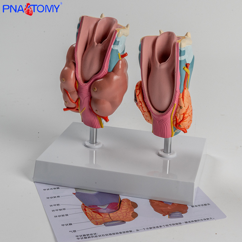 Human pathological thyroid model, hyperthyroidism, hypothyroidism, endocrine system, medical anatomy, thyroid larynx, teaching AIDS Specification image